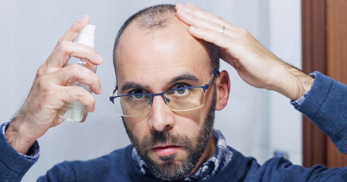 Kann man als Mann wirklich Haarausfall vorbeugen?