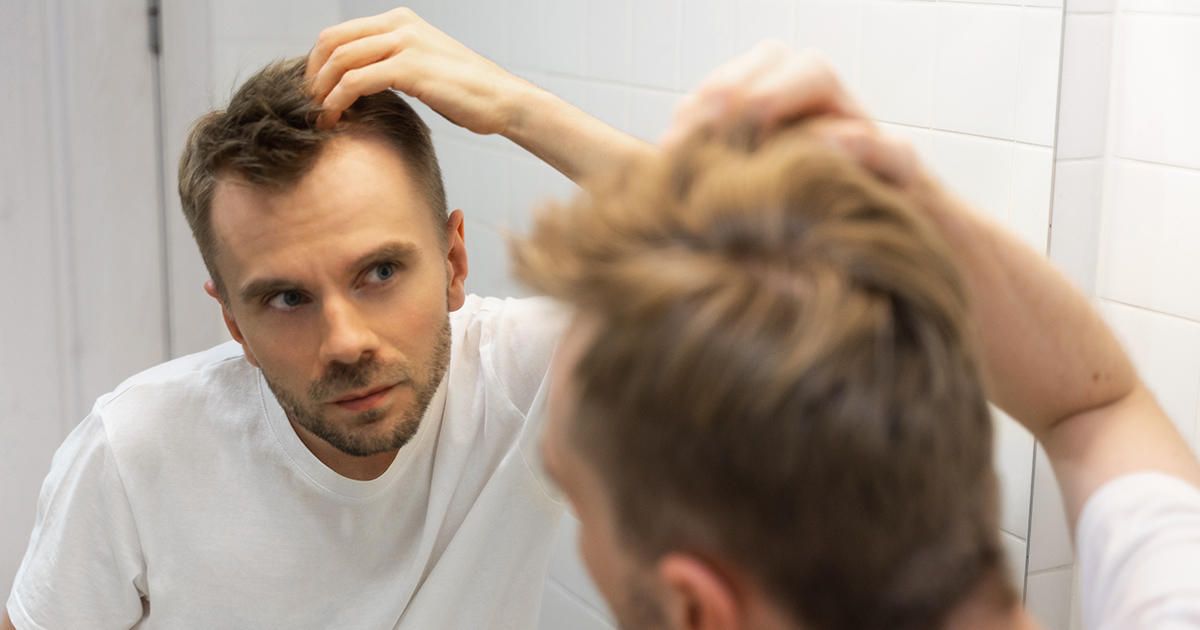 Najlepsze suplementy na wypadanie włosów u mężczyzn rekomendowanych marek w 2024 roku!