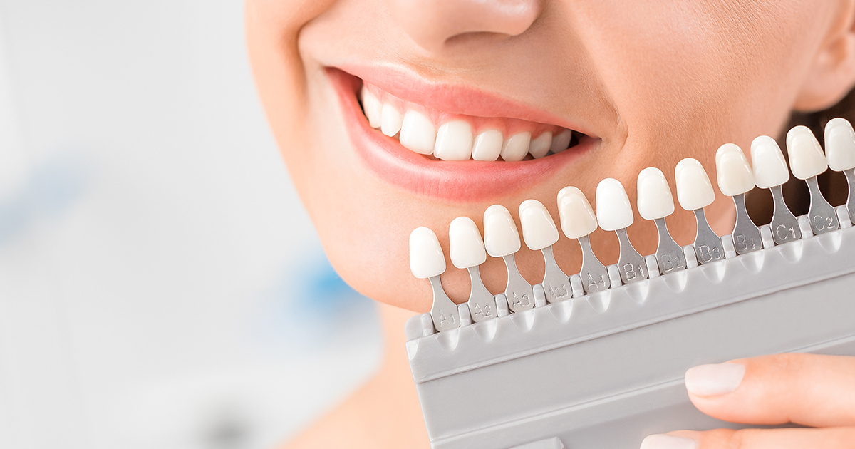 Najlepsze produkty do wybielania zębów – Ranking TOP 5 w 2024 roku