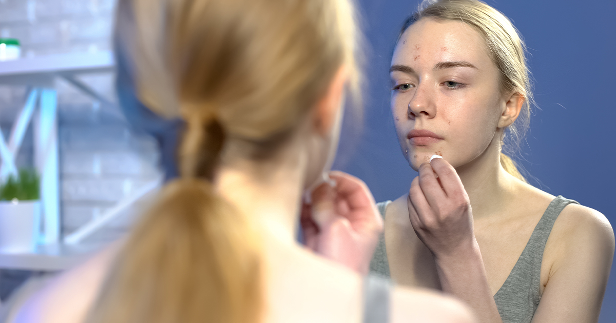 Ranking toników na trądzik – Najlepszy tonik na trądzik w 2026 roku