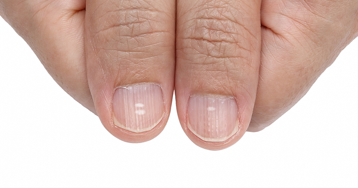 Ranking suplementów na białe plamy na paznokciach – najlepsze suplementy na białe plamy na paznokciach 2024 roku
