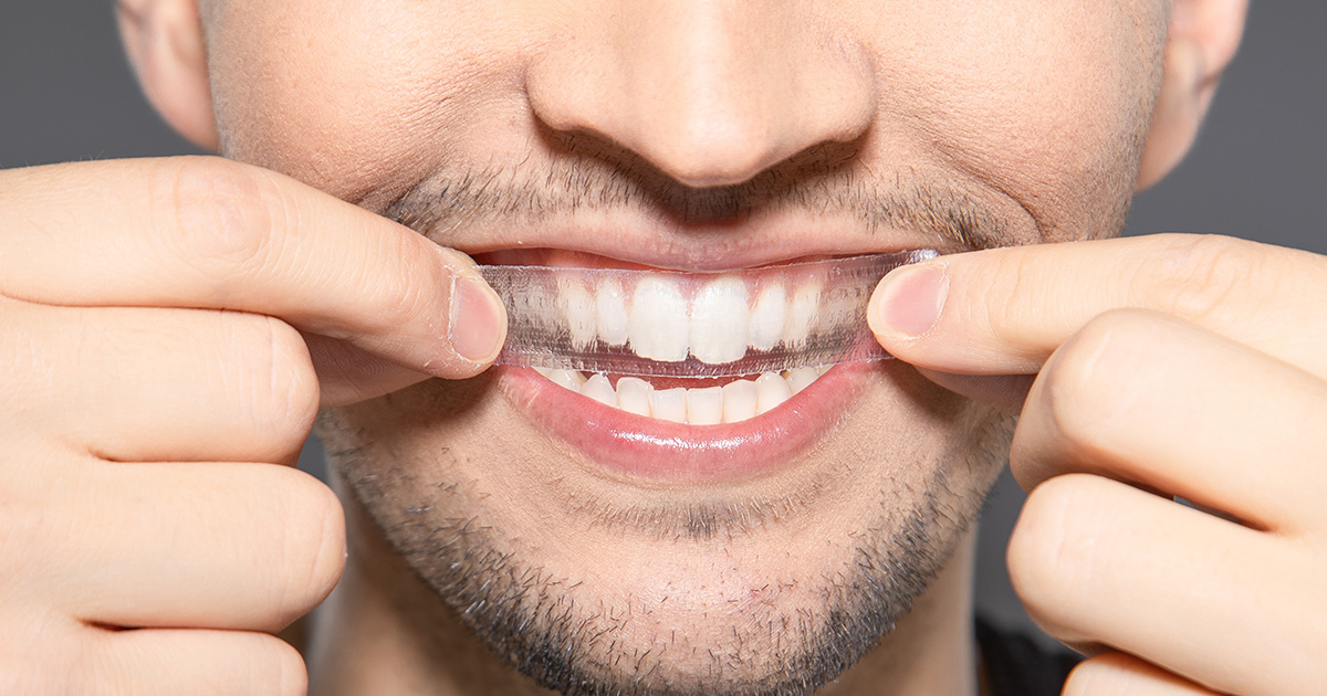 Ranking pasków wybielających – najlepsze paski wybielające zęby 2024 roku