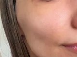 Orphica Clinic Anti-Acne, Maska oczyszczająco-regenerująca do cery trądzikowej z białą glinką 